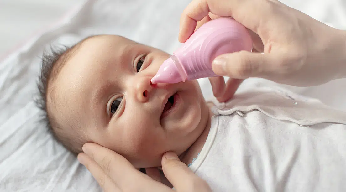 bebé con secreción nasal