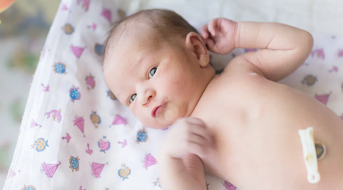 Cuidados del recién nacido: el cordón umbilical